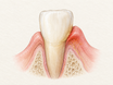 Close-up anatomical view of a lower front tooth and gum margin shows a thin plaque film at the gumline and mildly inflamed, slightly puffy gum tissue with fine nerve endings, illustrating a common source of itchy gums.